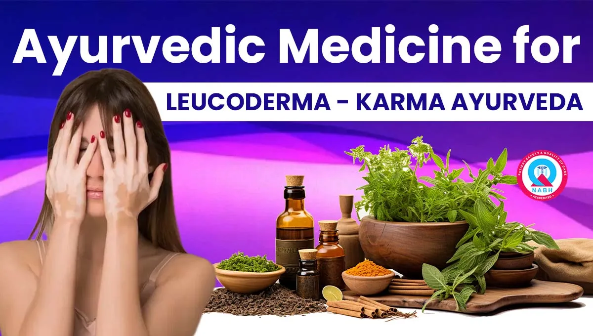 ayurvedic-medicine-for-leucoderma